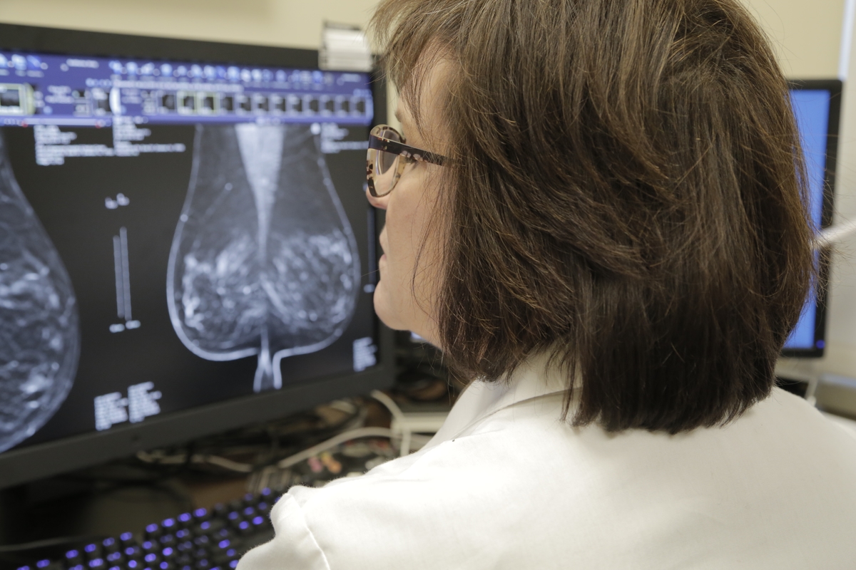 Doctor looking at a mammogram