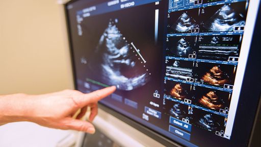 finger pointing at an ultrasound monitor